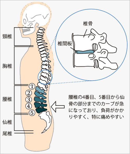 腰痛のメカニズム